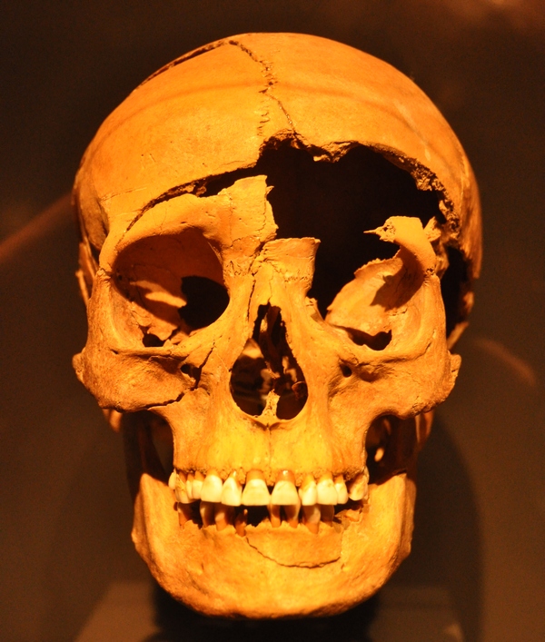 Regensburg-Harting, Skull